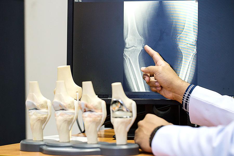 Orthopaedic surgeon giving patient a second opinion by showing them knee scan