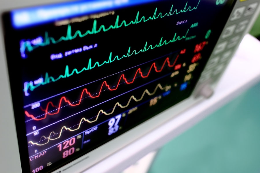 Closeup of heart monitor