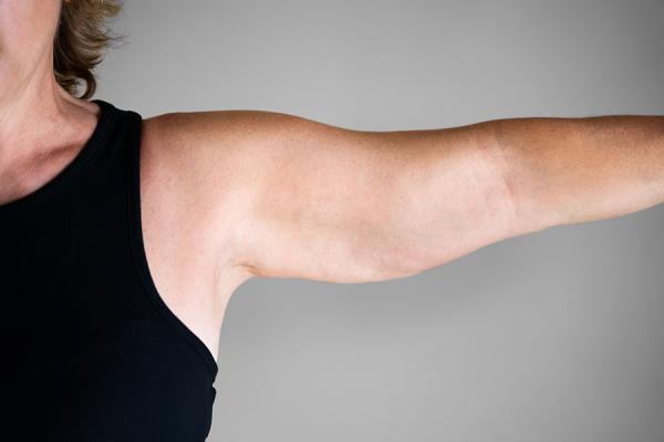 Woman holding her arm out