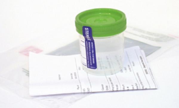 Urine Cup